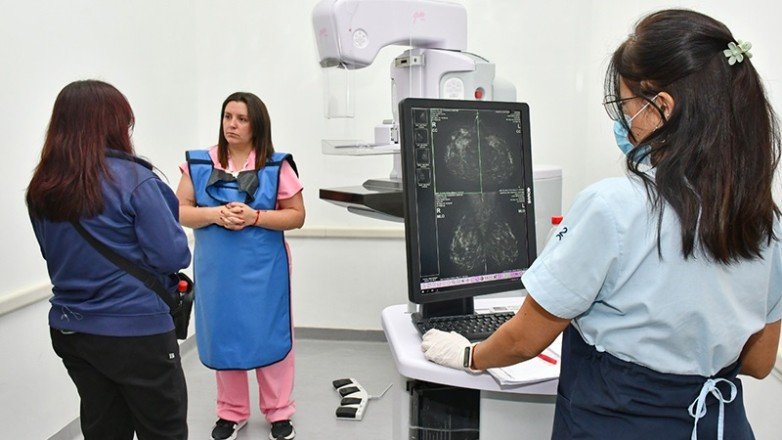Mamografías gratuitas para mujeres sin obra social: cuándo y quiénes pueden acceder